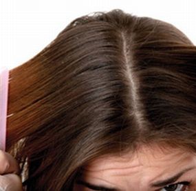 Como tirar escamações do couro cabeludo após a Progressiva