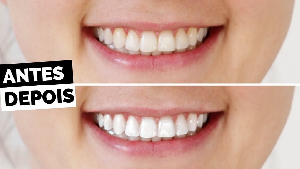 10 maneiras de clarear os dentes em casa naturalmente