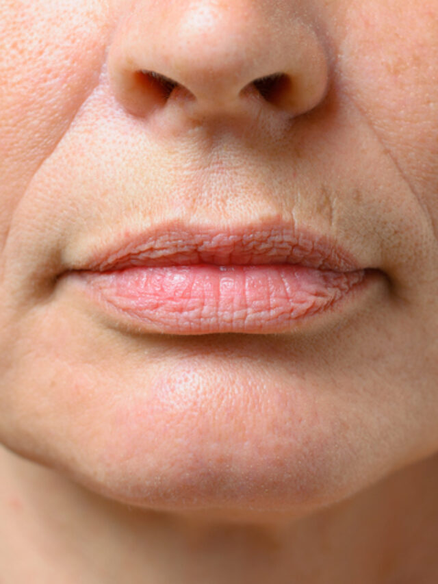 Melhor receita caseira para eliminar bigode chinês